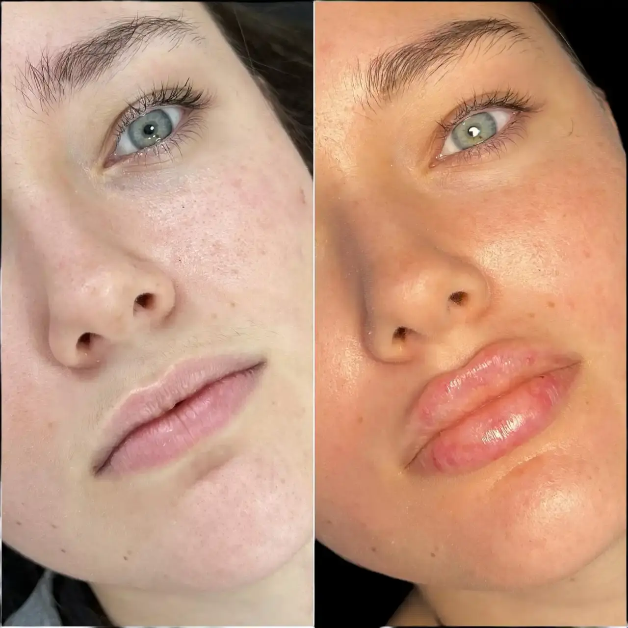 What Makes the Best Aesthetic Clinic in Dubai for Fillers Stand Out